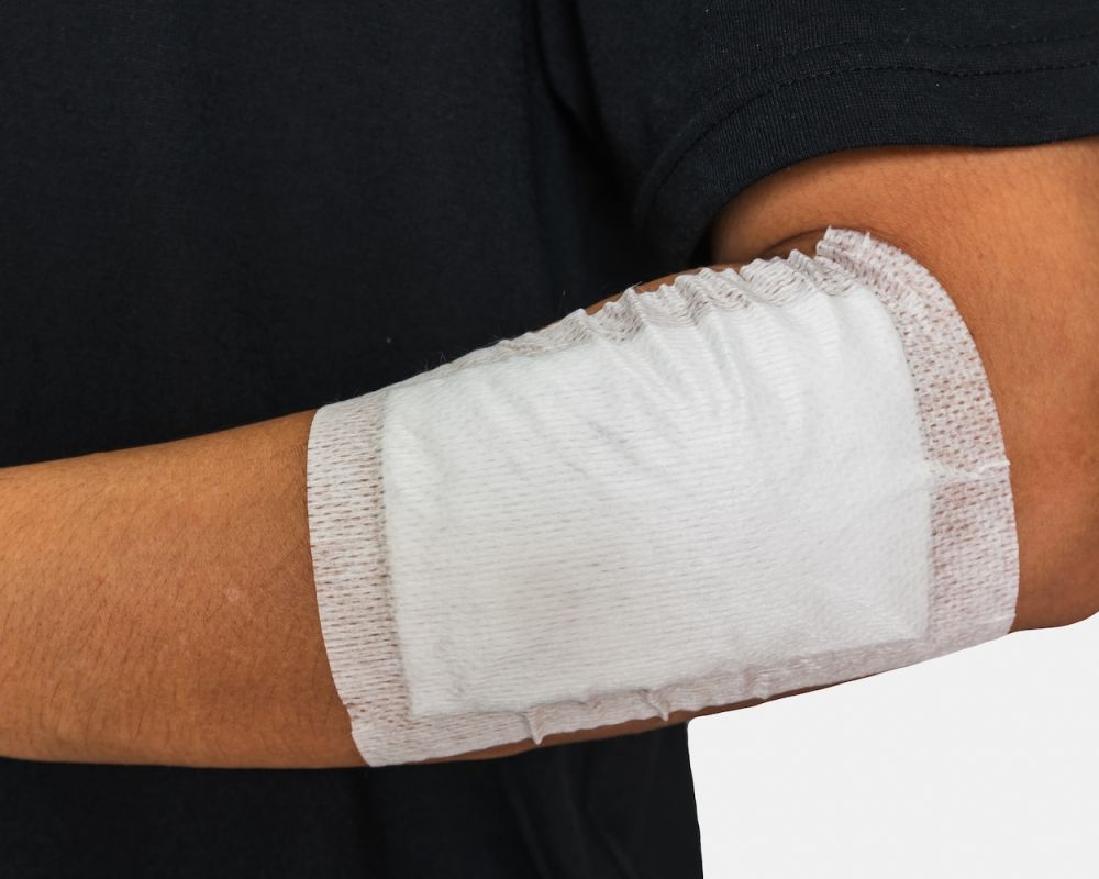 Arm with a bandaged elbow, showing wound care with a white sterile dressing against a black shirt background.