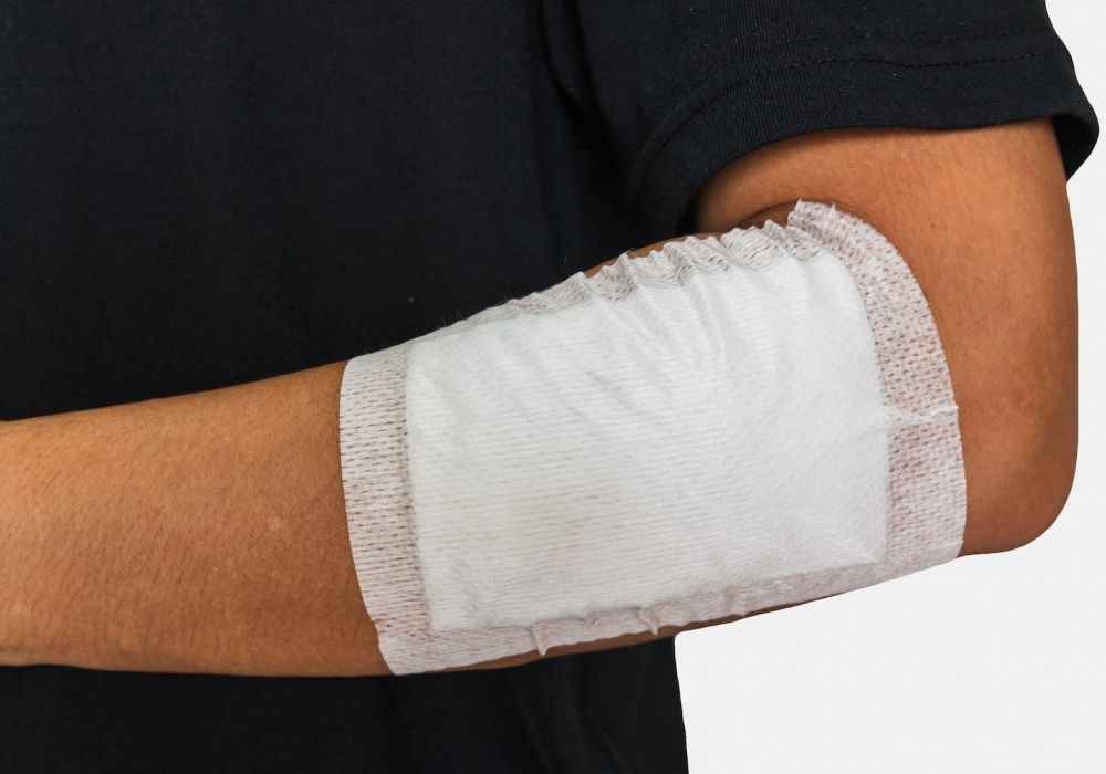 Arm with a bandaged elbow, showing wound care with a white sterile dressing against a black shirt background.